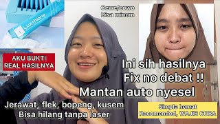 Mantan Aku Nyesel, Aku Bahagia. Terimakasih Luxthione. Review N Progress Ke Diri Aku Sendiri