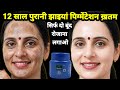 दही में दो चीज मिलाकर चेहरे पर लगा लो चेहरे से दाग धब्बे झाइयां होगी दूर चेहरा होगा गोरा चमकदार