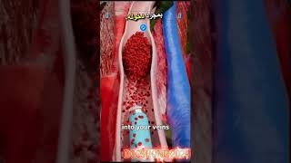 Removing Blood Clots with Vacuum