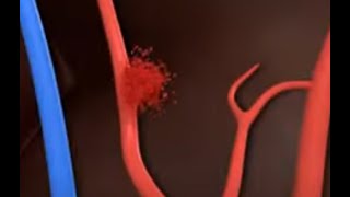 Rupture 100% By Gs Cold Real