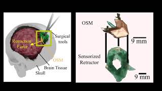 Capacitive Origami Sensing Modules for Measuring Force in a Neurosurgical, Soft Robotic Retractor
