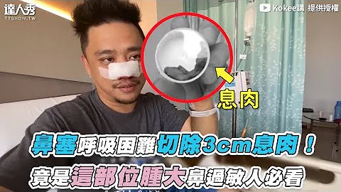 【鼻塞呼吸困难切除3cm息肉！竟是这部位肿大鼻过敏人必看】｜@kokeejiang - 天天要闻