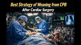 92 [Review Course] Best Strategy for Weaning from CPB after Cardiac Surgery🚑  TEE · MCS Algorithms