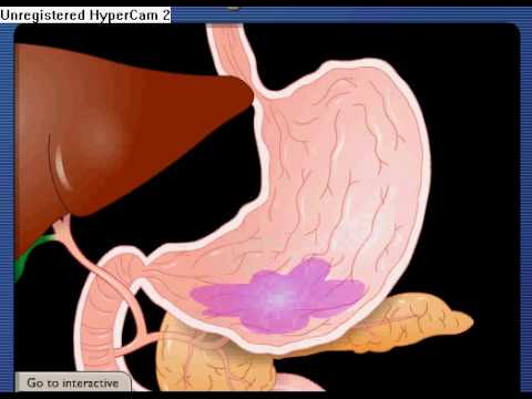 The digestion process - What happens to your food as it ... diagram of exits 