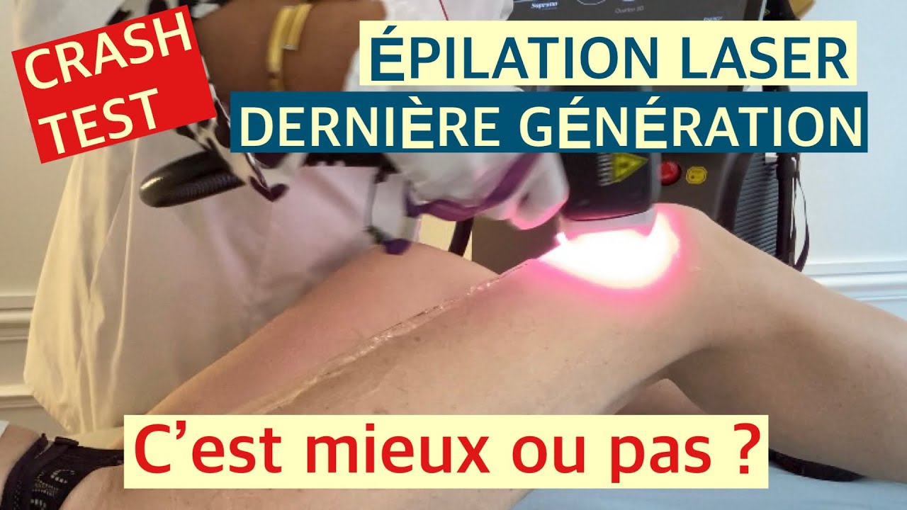 CRASH-TEST : ÉPILATION LASER DERNIÈRE GÉNÉRATION SOPRANO TITANIUM !