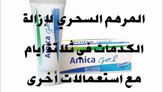 ARNICA GEL -الكريم السحري لإزالة الكدمات في ثلاثة أيام -  أ رنيكا جيل