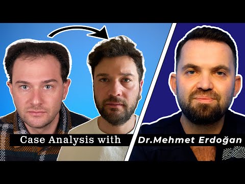 What is Norwood Scale? Explained Stages 1-7 8 YouTube video thumbnail