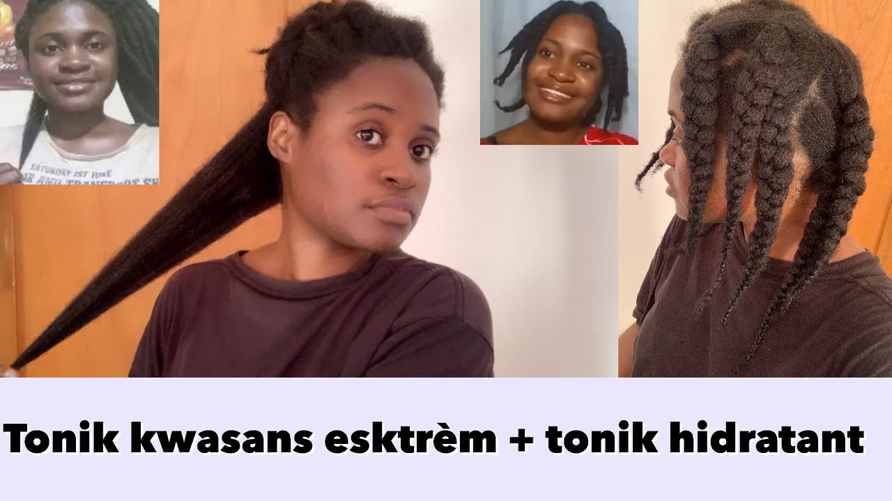 Avètisman!! Siw pa bezwen cheve founi e long pa gade video sa, paske losyon sa yo bay anpil cheve m!