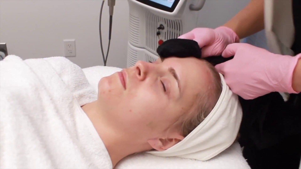 Glo & Go Laser Facial YouTube