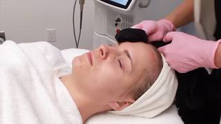 Glo & Go Laser Facial