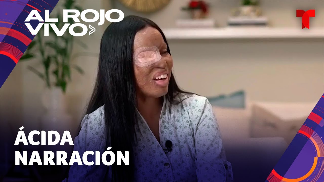 Víctima de ataque con ácido narra duros momentos tras la agresión y dice qué pasó con el responsable