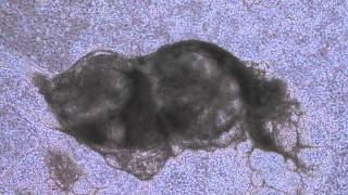 H9 Cardiac EBs.mov