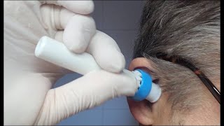 Test Elektrischer Ohrenreiniger. Ohrenschmalz Entferner testen. EarWax Remover Vaccuum Wattestäbchen