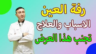 رفة العين الاسباب والعلاج | خطورة رفة العين | احذر هذه الأعراض