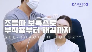 사각턱보톡스 부작용, 대표적인 3가지! 효과적인 해결방법은 [초음파보톡스 vol.2]