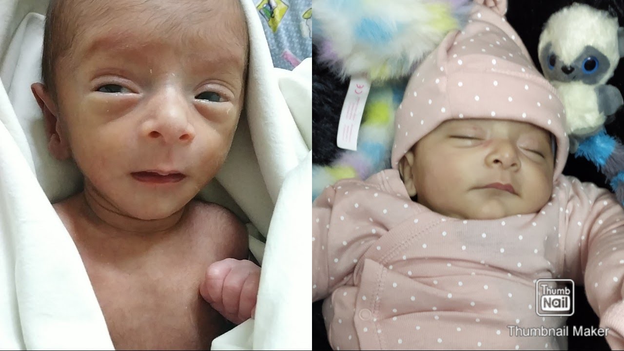 Premature Baby | IUGR | 3 months old update