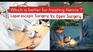 Laparoscopic Surgery vs Open Surgery, Difference, in Hindi, Laparoscopic Surgery Benefits in Hindi