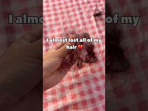 I almost lost all of my hair 💔🥺
