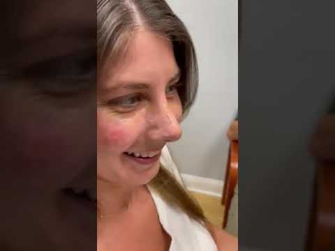 Video thumbnail: 3 Weeks Post-Rhinoplasty Reveal! 👃✨ · Becker Rhinoplasty Center