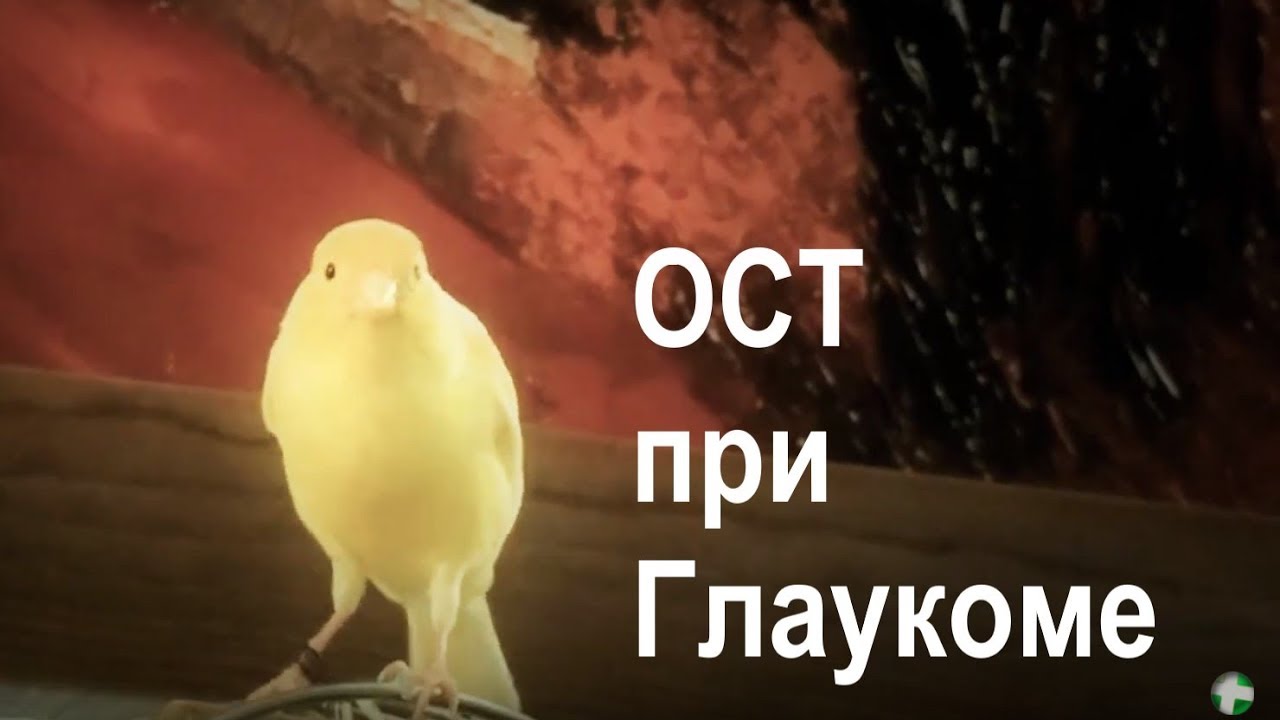 Оптическая когерентная томография (ОКТ, ОСТ) при глаукоме.