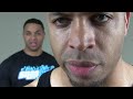 Are Supplements A Big Scam @Hodgetwins