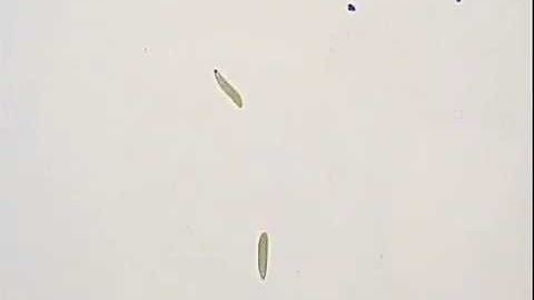 Channelrhodopsin in Drosophila motor neurons