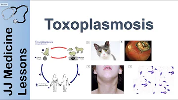 Proč je toxoplazmóza u dětí nepříjemná?