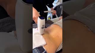 Discover the Power of #DiodeLaser for #LaserHairRemovalAchieve long-lasting results with advanced