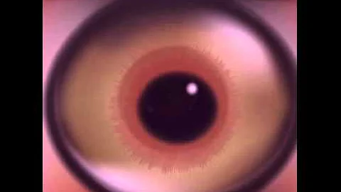 Apple of My Eye