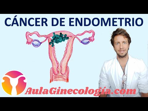 Vídeo: Un Diagnóstico Intraoperatorio Exitoso De Linfoma Coexistente Y Cáncer De Endometrio