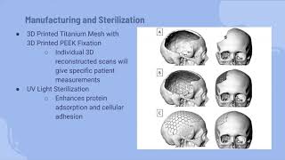 Group 15 Final Presentation   3D printed Cranioplastic Implants