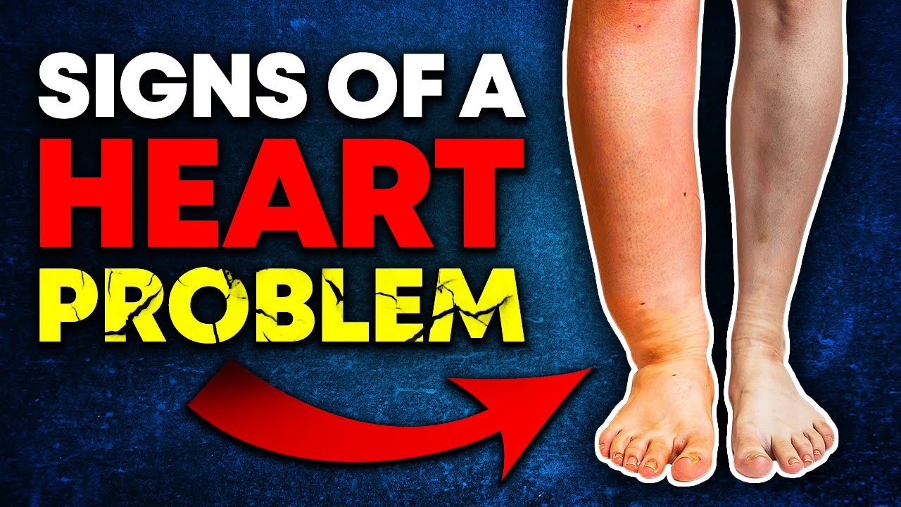10 Signs Of Heart Problems You Shouldn't Ignore (Your Heart May Be In ...