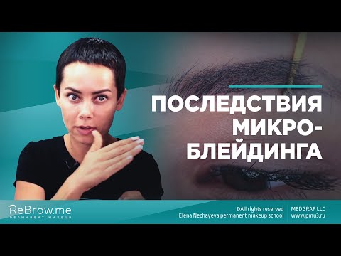 Последствия микроблейдинга #микроблейдинг