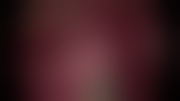 SUBLOBAR RESECTION: UNIPORTAL ANATOMIC RIGHT S10 SEGMENTECTOMY