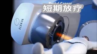 External Beam Radiotherapy For Colorectal And Anal Cancer - Chinese Simplified