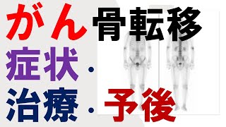 がん骨転移：症状、治療と予後（生存率）について医師が解説