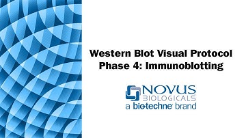 Western Blot Visual Protocol: Phase 4: Immunoblotting