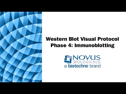 Western Blot Visual Protocol: Phase 4: Immunoblotting