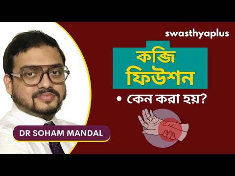 কব্জি ফিউশন কেন করা হয়? | What is Wrist Fusion (Arthrodesis)? in Bangla | Dr Soham Mandal