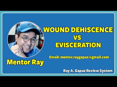 Gapuz Mentors: PRIORITIZING NCLEX REVIEW on WOUND DEHISCENCE VS EVISCERATION