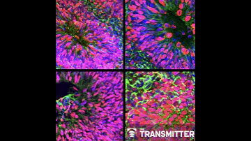 New organoid atlas unveils four neurodevelopmental signatures