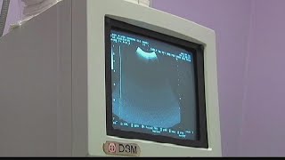 Medical vs. surgical abortion | What to know