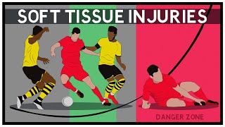 Soft Tissue Injuries: What Are They And Why Are They Happening More? screenshot 1