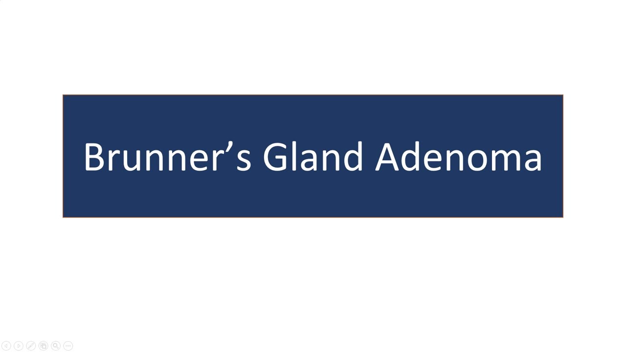 Brunner's gland adenoma YouTube