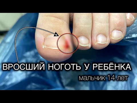 ДЛЯ ЛЮБИТЕЛЕЙ МОИХ ВКУСНЫХ ВИДЕО #аленалаврентьева #подолог #подология #обучениеподологии