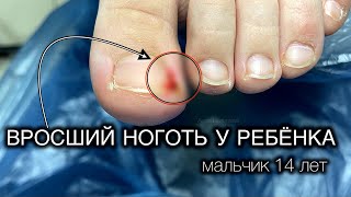 ДЛЯ ЛЮБИТЕЛЕЙ МОИХ ВКУСНЫХ ВИДЕО #аленалаврентьева #подолог #подология #обучениеподологии