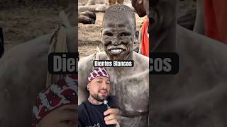Dientes blancos #dentista #teeth #teethwhitening #dientesblancos #tooth #toothpaste #dentist