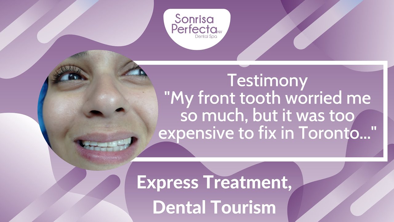 1 WEEK DENTAL TREATMENT IN MEXICO 🤯🤩 Dental Tourism in Mexico