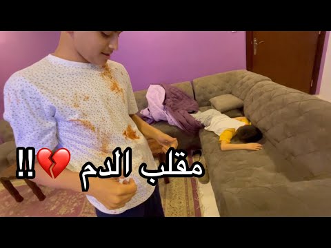 مقلب بسعود وبدر لا يفوتكم طلع من راسي دم