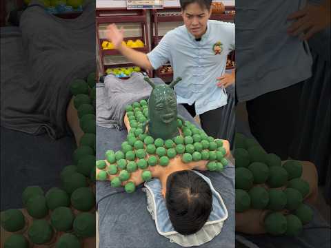 Cupping Plankton “AUHGGG” #cuppingtherapy #cupping #massage #viral